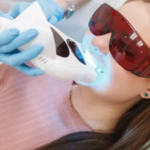 Laser Teeth Whitening