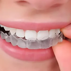Invisible Braces