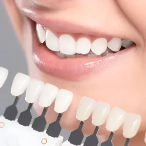 Teeth in an hour