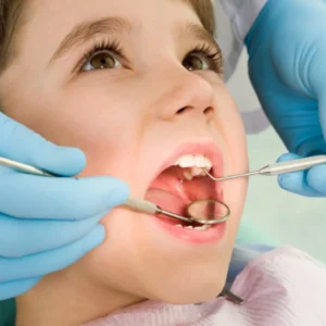 Fillings