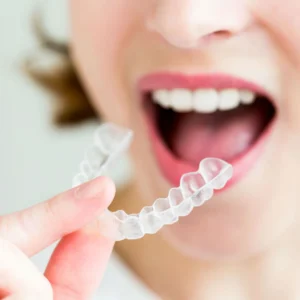 Invisalign