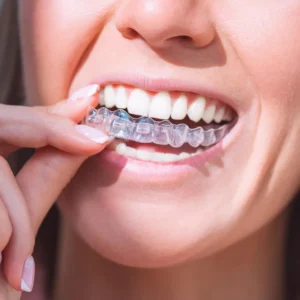 Aligners