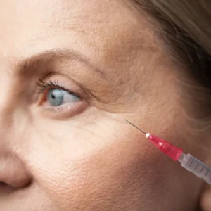 Anti-wrinkle injections