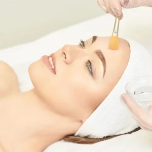 Chemical peels