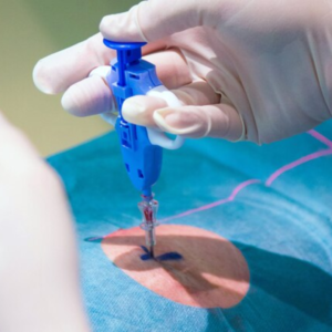 Biopsies