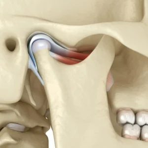 TMJ issues