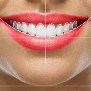 Digital smile designing