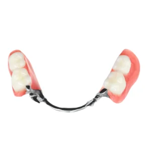 Cast Partial Denture