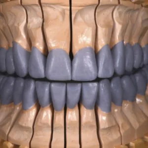 Step-by-Step Restoration