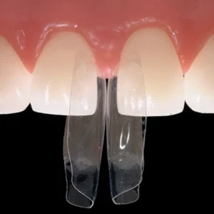 Bioclear Strips